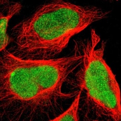 C1orf174 Antibody, Novus Biologicals:Antibodies:Primary Antibodies